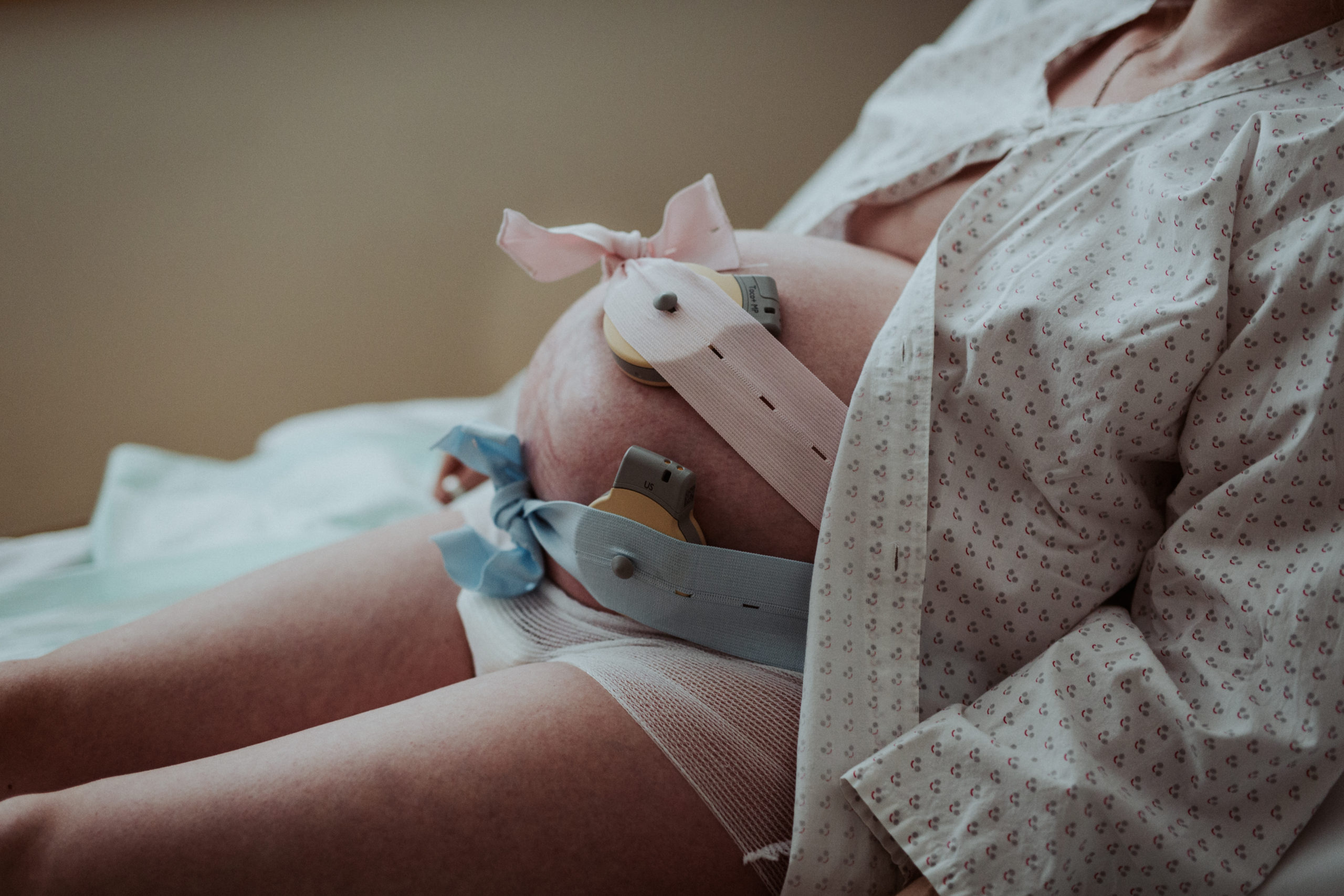 Bild 02 der Reportage 04: Geburt und erste Babymomente
