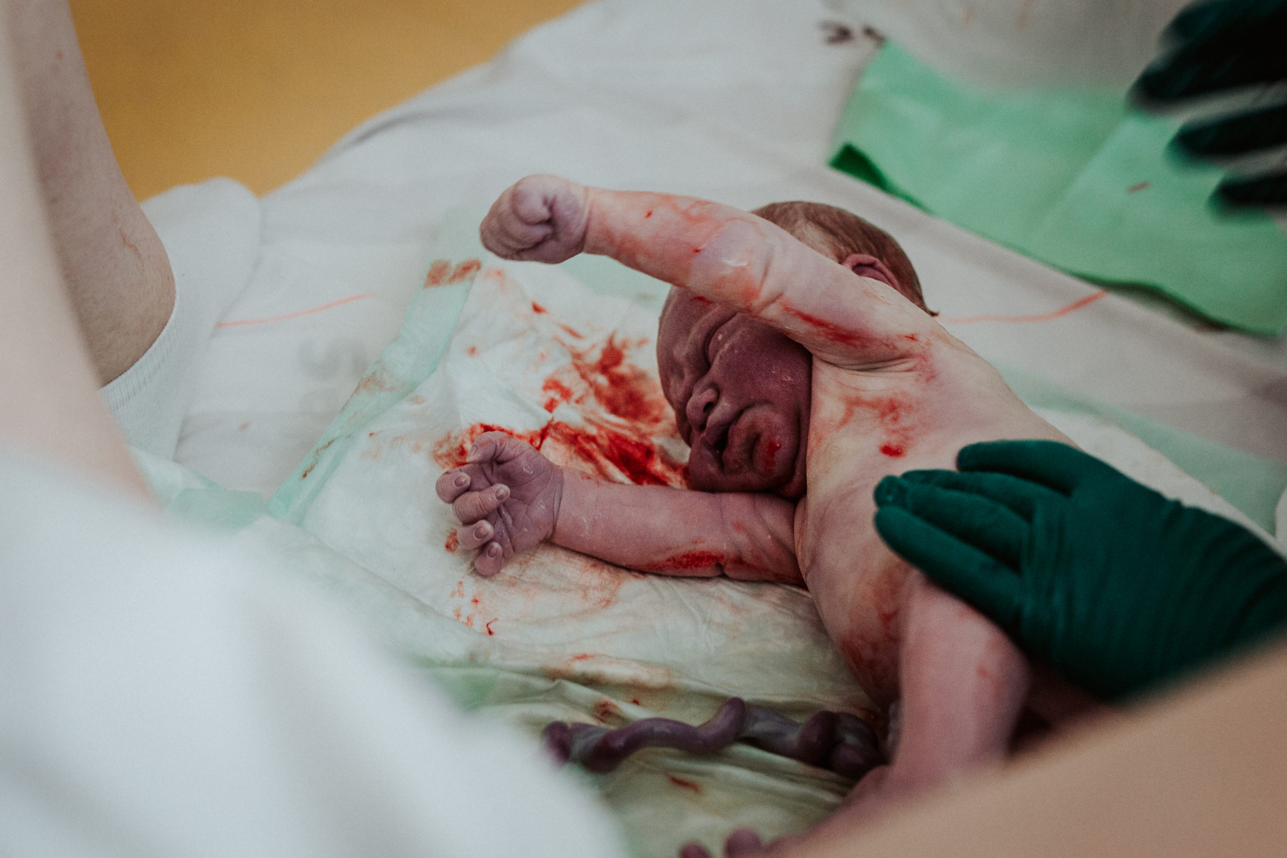 Bild 04 der Reportage 04: Geburt und erste Babymomente